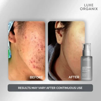 Luxe Organix Whitening Repair Ultra Light Glow Moisturizer