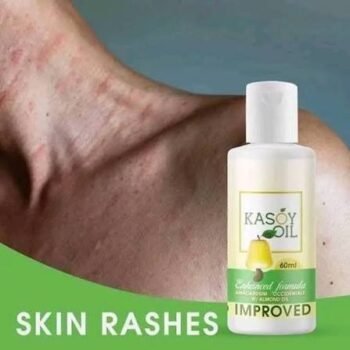 ANGEL TOUCH KASOY OIL 60ML - Image 3
